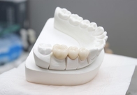 Co-Cr Dental Base Metal Alloy