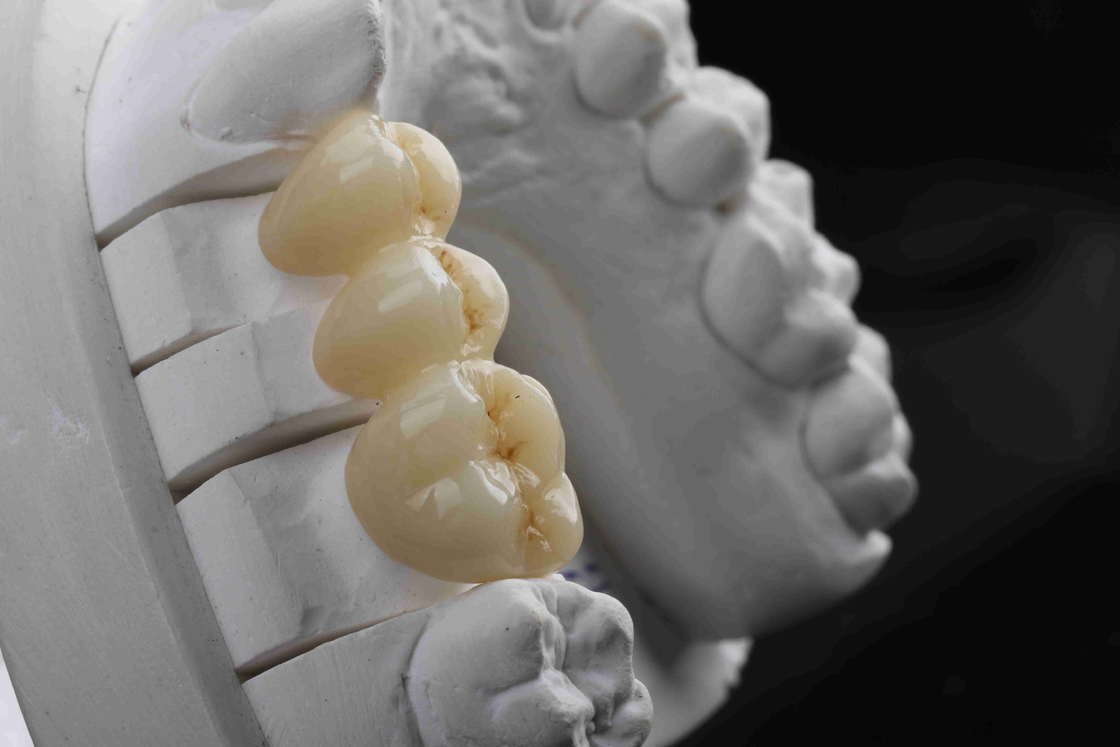 3D Multilayer Dental Zirconia Block Natural Gradient High Transmittance