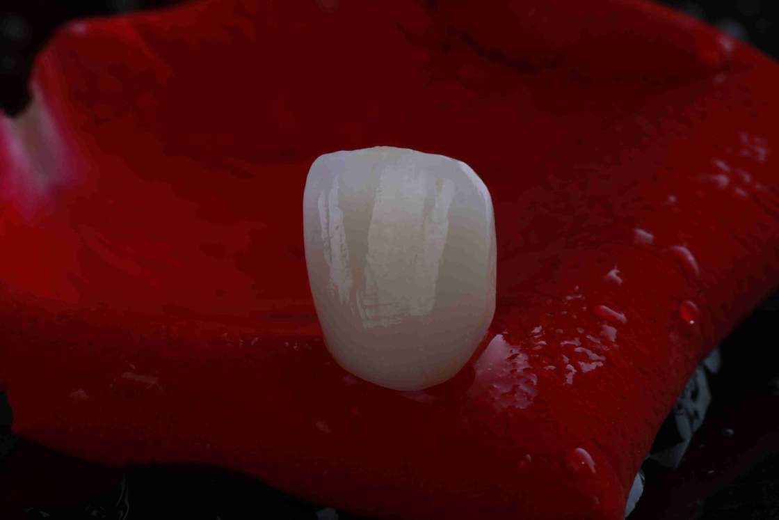 Natural Gradient 3D Multilayer Dental Zirconia Block